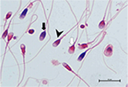 Mikroskopowa ocena